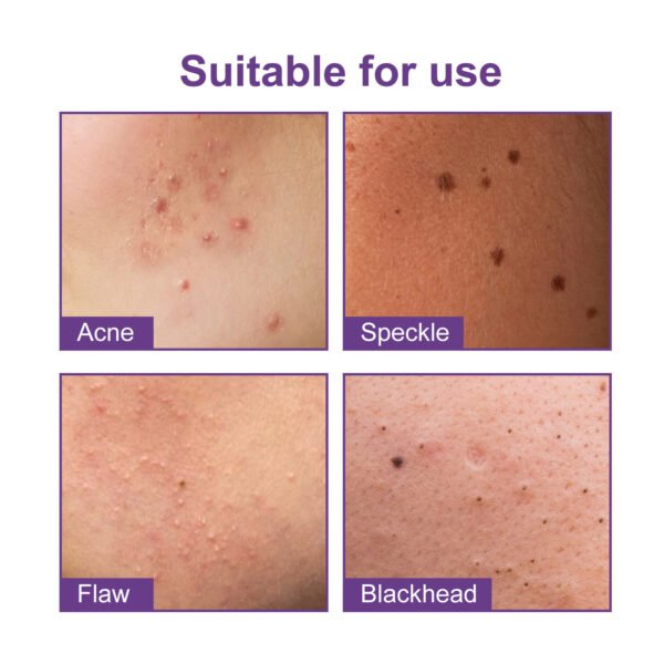 EELHOE Pimple patches. Hydrocolloid patches for facial skin to close pores and clean pimples - Image 8