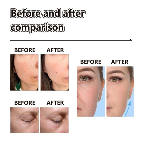 EELHOE Retinol Moisturizing face cream Firms the Relaxed Face, Fine Pore Moisturizing and Wrinkle Resisting face cream - Image 12