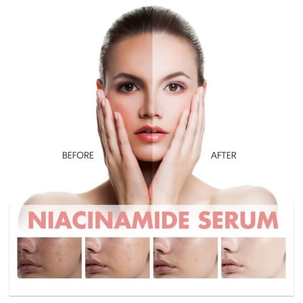 Hoygi nicotinamide essence tightens and moisturizes pores, reduces acne, fine lines, spots, tender skin, moisturize and whiten skin - Image 7