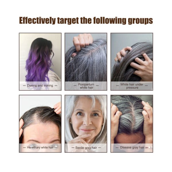 Jaysuing Black Hair essence Scalp Care Massage Moisturizing Hair Firming Hair Lotion Black Hair essence - Image 8