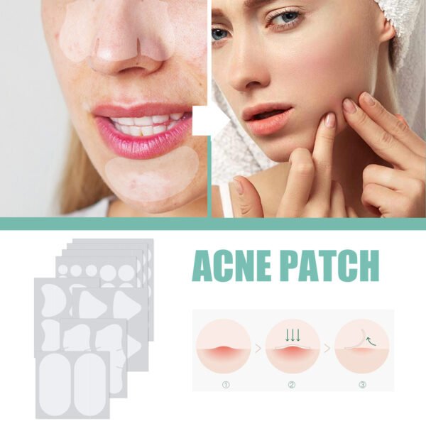 EELHOE Pimple patches. Gentle and non-irritating, they clean and comfort facial pores and skin. Care patches - Image 9