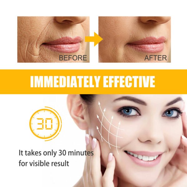 Jaysuing Collagen smile line patches. Lift facial smile lines, tighten the skin, and smooth out and fade wrinkles. - Image 4