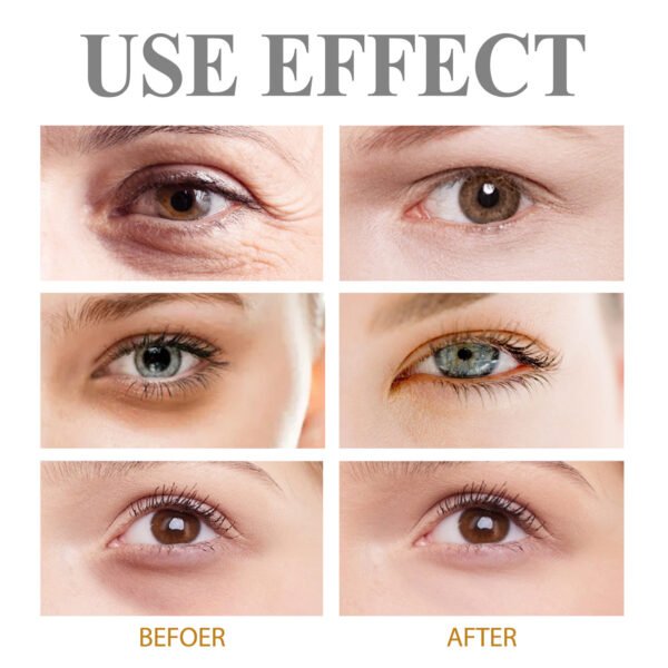 JAYSUING Firming eye cream. Fades dark circles and fine lines, provides hydration, moisturizes, lifts, resists wrinkles, and firms the eye area skin - Image 6