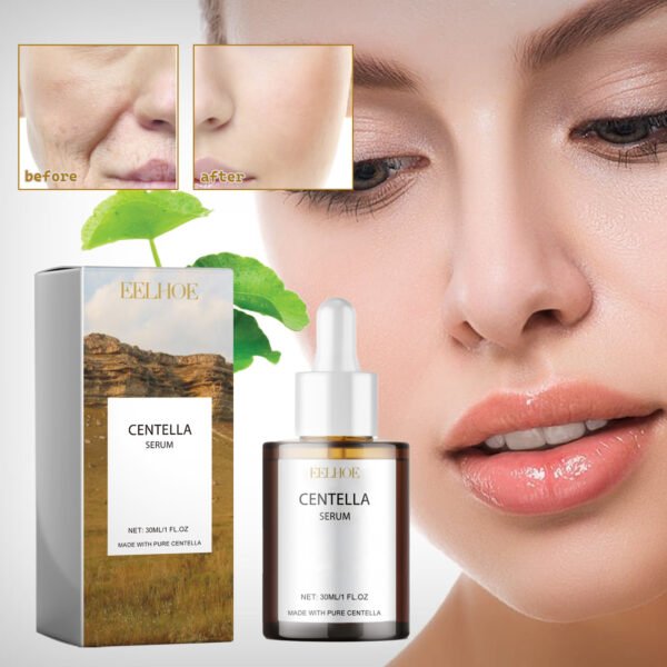 EELHOE Centella asiatica essence. Moisturize and nourish the skin, improve dryness, make the skin smooth and delicate, brighten the complexion and replenish water - Image 7