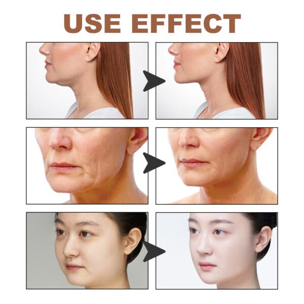 EELHOE  Myofascial facial tightening band to lift the face, prevent sagging, tighten the chin, create a V-shaped face, breathable face-lifting sticker - Image 10