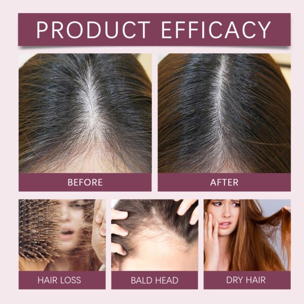 HOEGOA hair care oil improves dry and frizzy hair, nourishes smooth hair, scalp care hair oil - Image 10