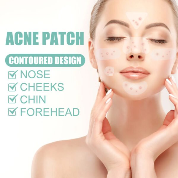 EELHOE Pimple patches. Gentle and non-irritating, they clean and comfort facial pores and skin. Care patches - Image 2