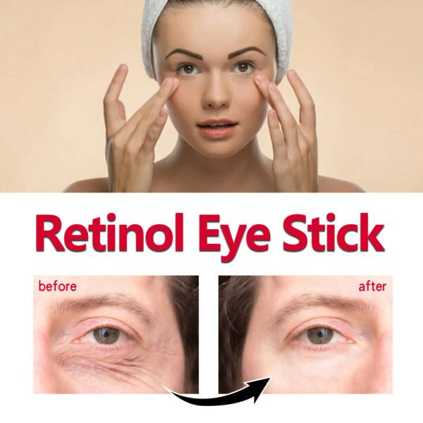 EELHOE Retinol eye cream stick. Moisturize the skin around the eyes, improve the condition of the eyes, and fade fine lines, crow's feet, and nasolabial folds. - Image 2
