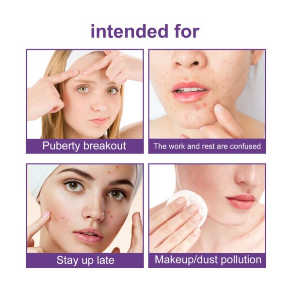 EELHOE Pimple patches. Hydrocolloid patches for facial skin to close pores and clean pimples - Image 4