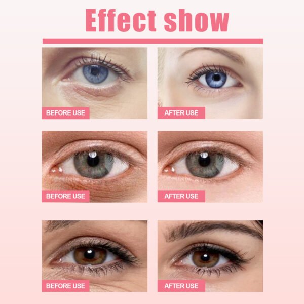 WestMonth Rosehip eye cream stick for moisturizing, hydrating, reducing fine lines, dark circles, and tightening the eye area - Image 6