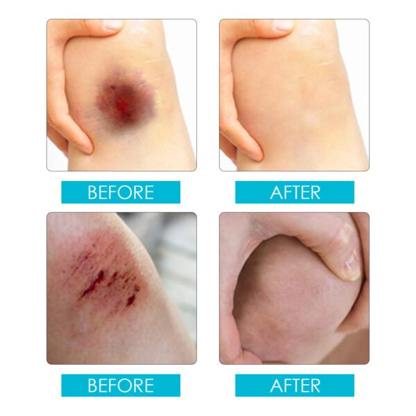 Jaysuing Waterproof liquid band - aid spray. A wound - protecting, invisible film - forming, waterproof and breathable nursing spray - Image 8