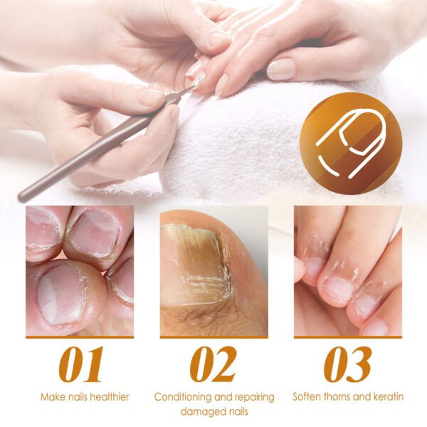 EELHOE Instant Cuticle Care Gel, Repairing Nail Fungus, Soft Nails, Rotten Nails and Dead Skin, Moisturizing Care Liquid - Image 5