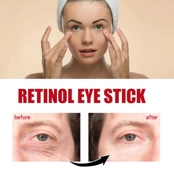Jaysui Retinol Anti Wrinkle Eye Cream moisturizes and cares for staying up late, dark circles, eye bags, eye wrinkles, and eye area cream - Image 2
