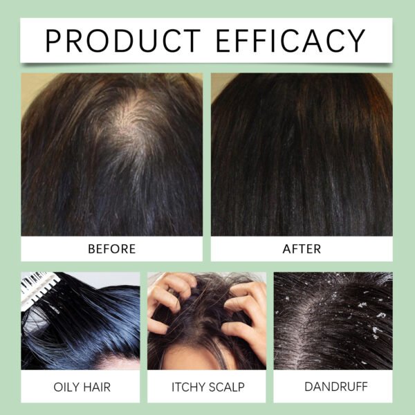 HOEGOA Rosemary scalp scrub. A gentle hair cleanser that moisturizes, cools, and soothes the scalp - Image 10