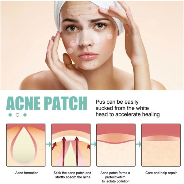 EELHOE Pimple patches. Gentle and non-irritating, they clean and comfort facial pores and skin. Care patches - Image 10
