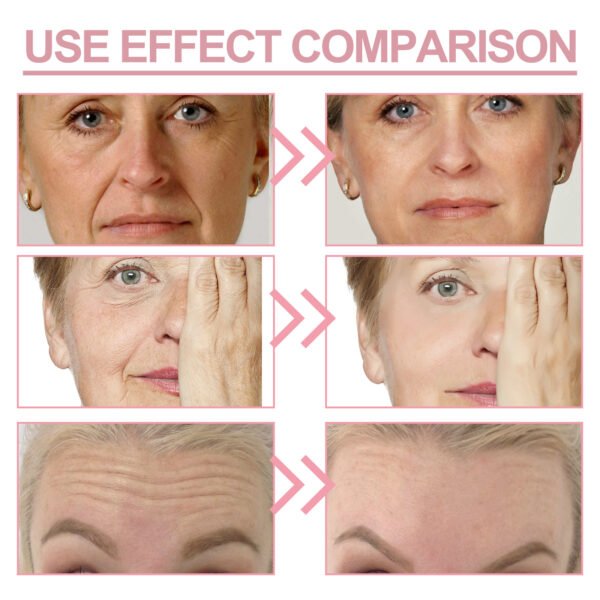 JaysuingEye care cream: Hydrates and nourishes the skin, fades fine lines around the eyes and face, and brightens the skin - Image 10