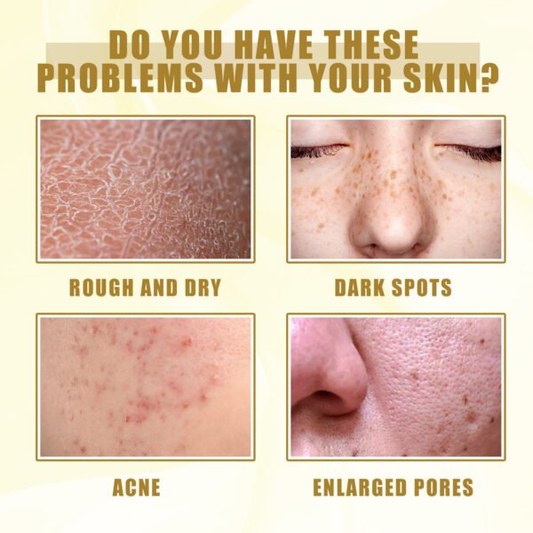 EELHOE Exfoliating oil. Deeply cleanses and exfoliates dead skin, fades spots, moisturizes and whitens the skin. A skin - beautifying oil - Image 8