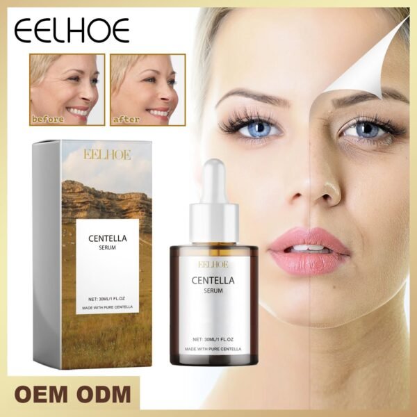 EELHOE Centella asiatica essence. Moisturize and nourish the skin, improve dryness, make the skin smooth and delicate, brighten the complexion and replenish water