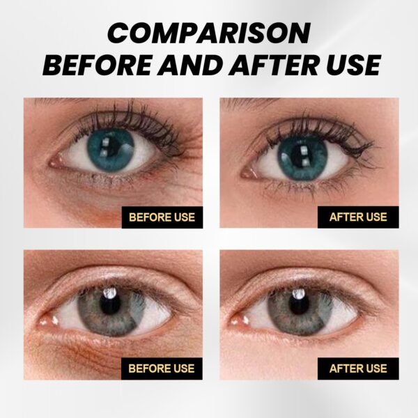 EELHOE Instant firming eye cream. It hydrates, moisturizes and firms the skin around the eyes, and fades wrinkles, dark circles and eye bags. - Image 19