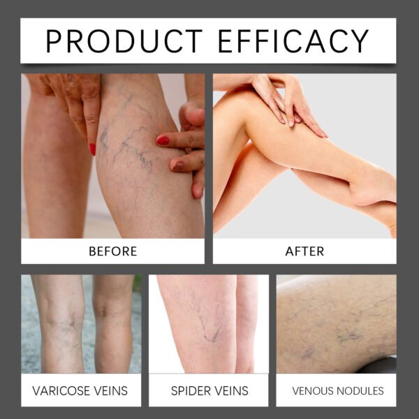 OCEANA Leg Care Cream Gently Relieves Leg Discomfort Daily Massage External Care Cream - Image 2