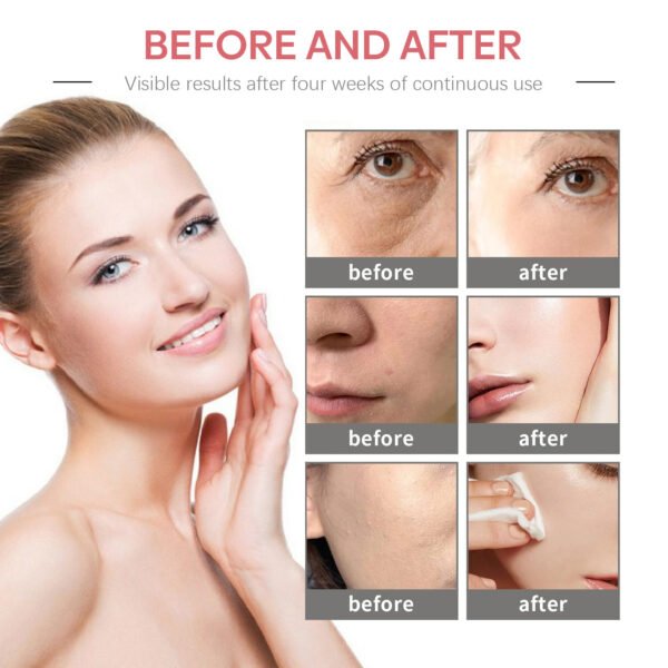 Jaysuing  5-in-1 Firming Cream. A facial cream that firms, reduces wrinkles, moisturizes, and protects the skin from aging. - Image 13