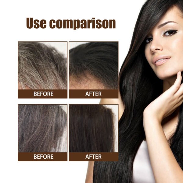 Jaysuing Black Hair essence Scalp Care Massage Moisturizing Hair Firming Hair Lotion Black Hair essence - Image 2