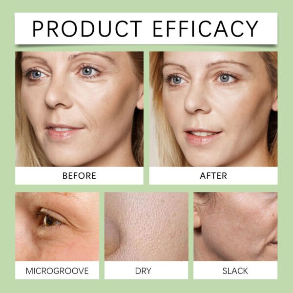 HOYGI Moisturizing essence Moisturizing, delicate, shiny, moisturizing and elastic facial essence - Image 9