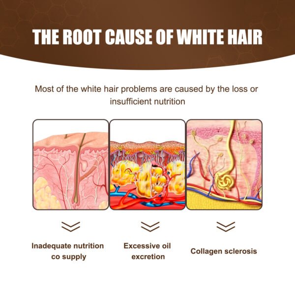 Jaysuing Black Hair essence Scalp Care Massage Moisturizing Hair Firming Hair Lotion Black Hair essence - Image 7