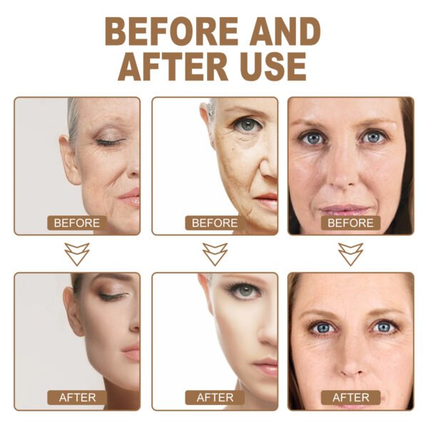 Hoygi Anti-aging cream. It can fade facial fine lines, moisturize and nourish the skin, brighten and tighten the skin. Anti-wrinkle cream - Image 3