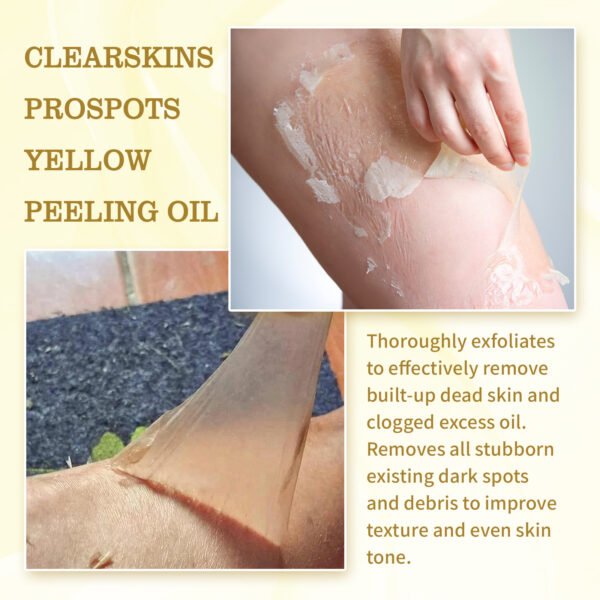 EELHOE Exfoliating oil. Deeply cleanses and exfoliates dead skin, fades spots, moisturizes and whitens the skin. A skin - beautifying oil - Image 9