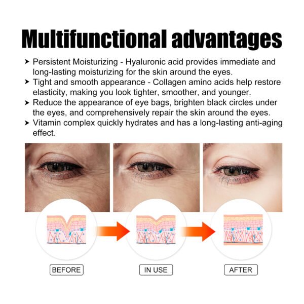 EELHOECollagen gold eye mask. Tighten eye wrinkles. Eye patches for repairing dark circles and eye bags caused by staying up late, making the eyes elastic - Image 9